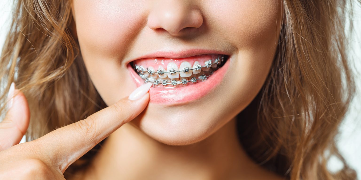 Orthodontie Digital Dental Clinic