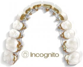 incognito